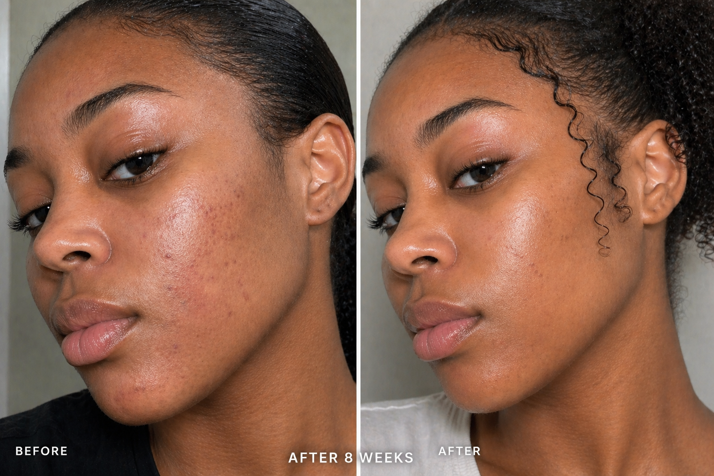 Pure: Niacinamide Serum by Yany Beauty